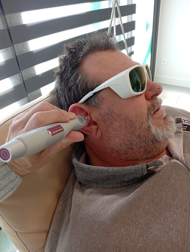 photo seance Tatérapilaser