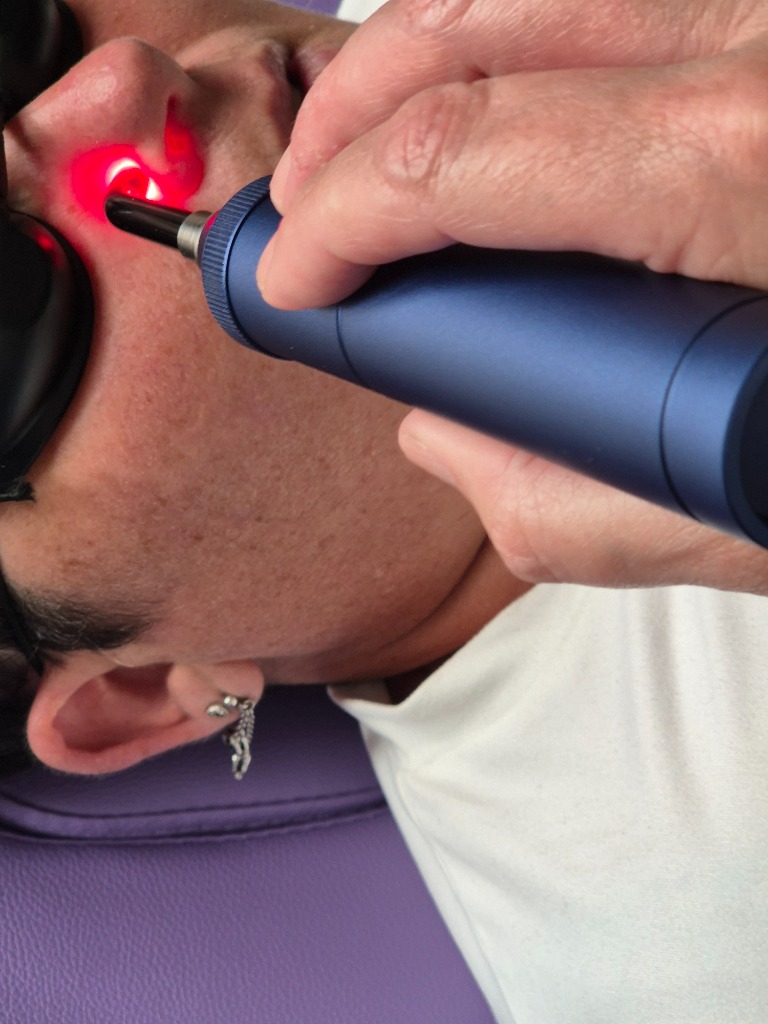 photo seance Mathilde Paboeuf sevrage laser