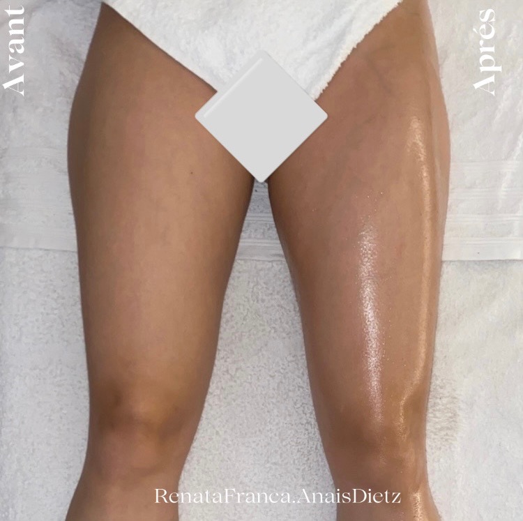 photo activite Anaïs Dietz