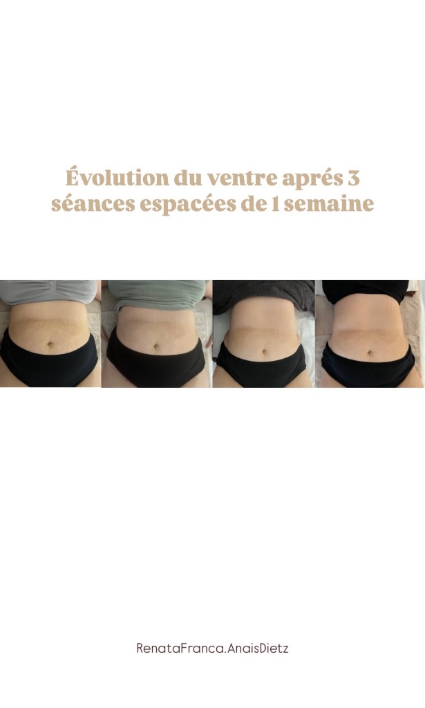 photo seance Anaïs Dietz