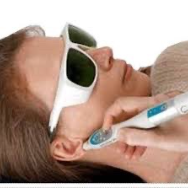 Laser efficience Belfort