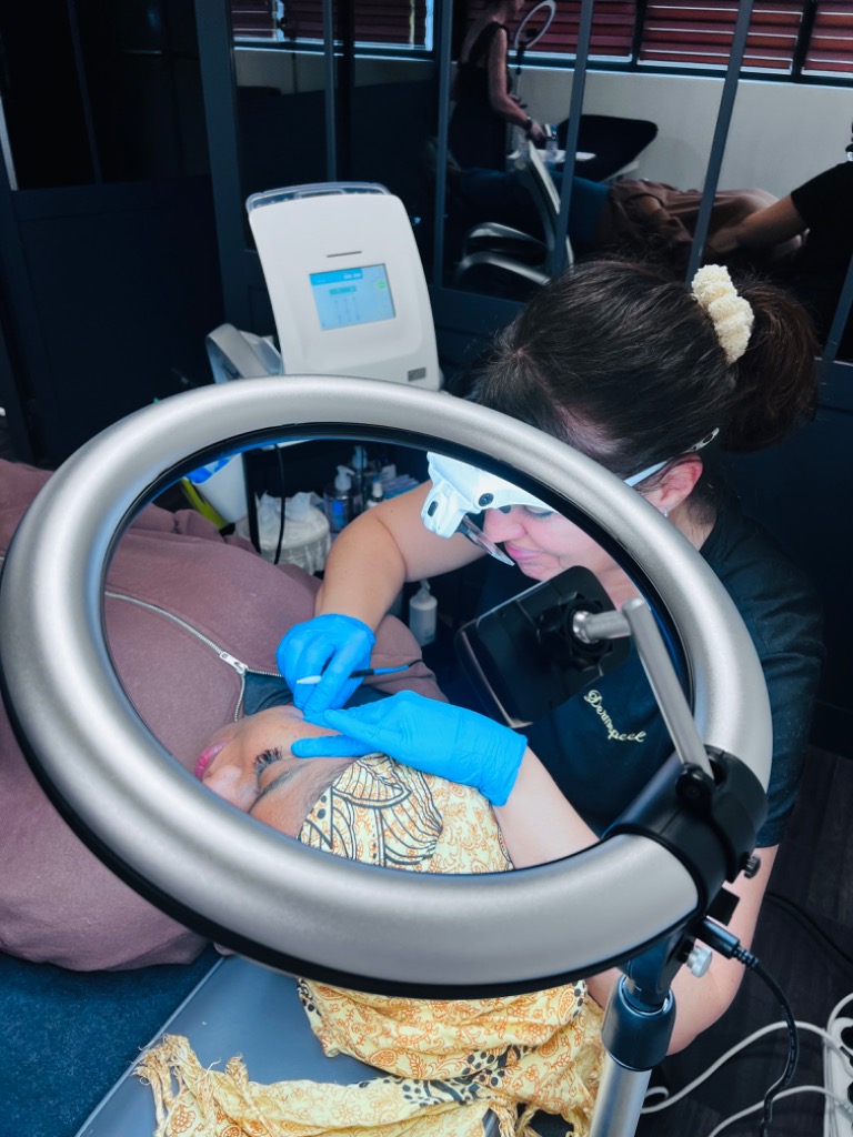 photo seance DERMOPEEL