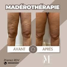 photo seance LYMPHEA 