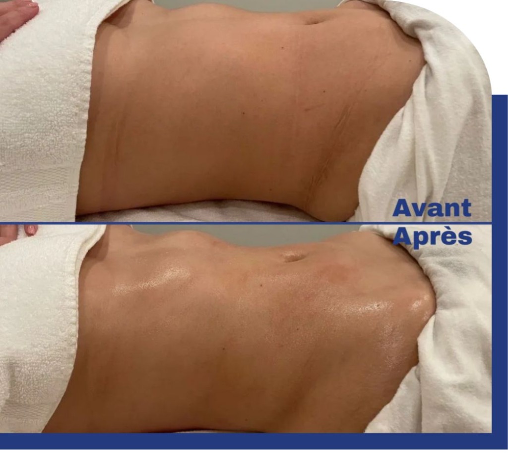 photo activite Alexandre | Drainage lymphatique & massage