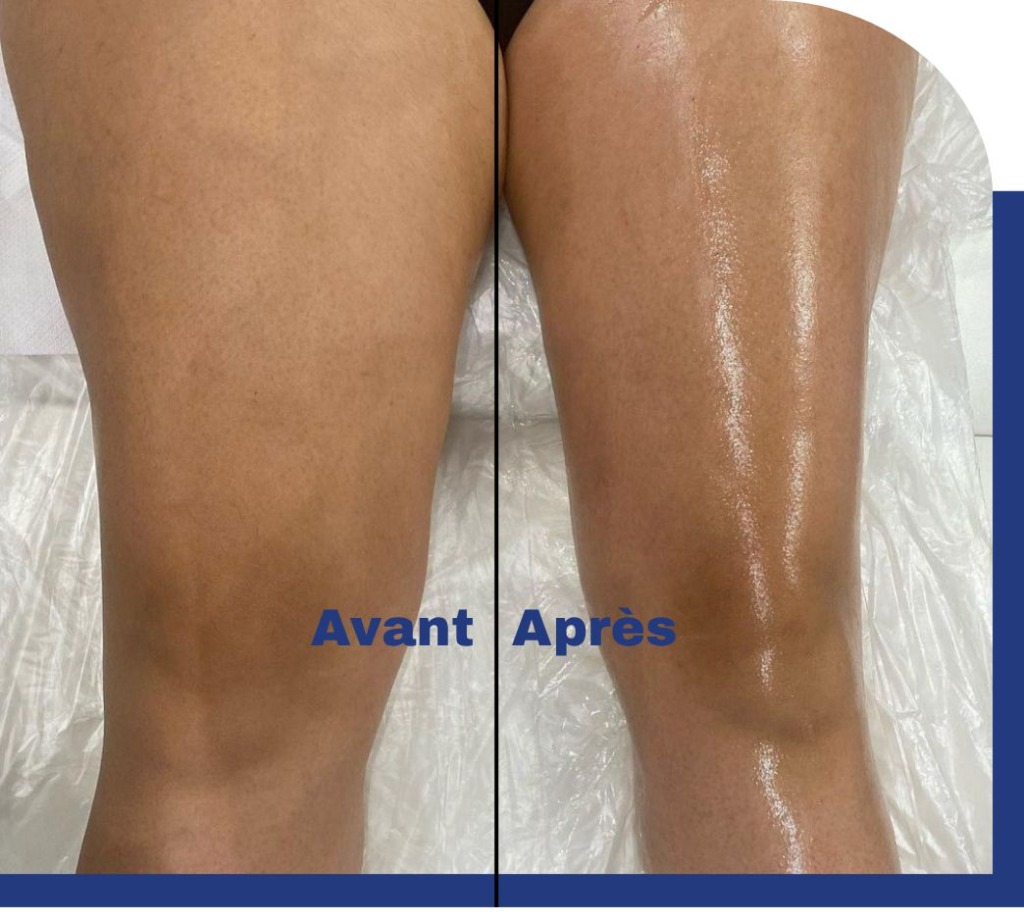 photo diplome Alexandre | Drainage lymphatique & massage