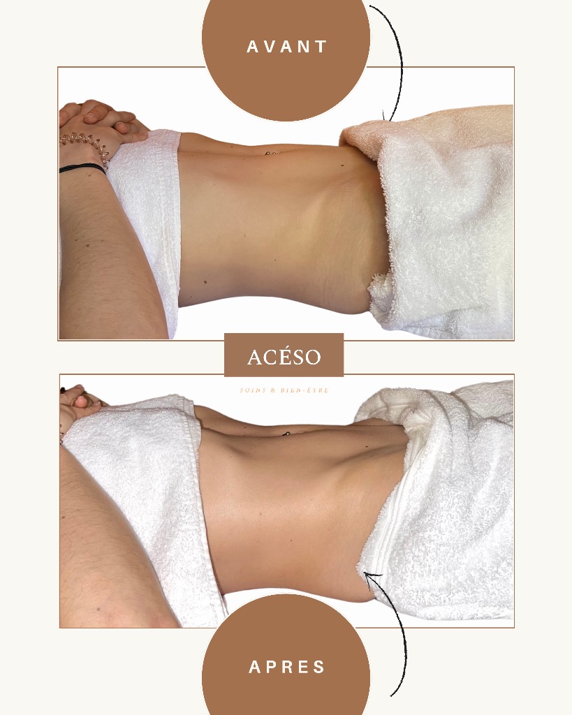 photo seance Aceso Drainage 