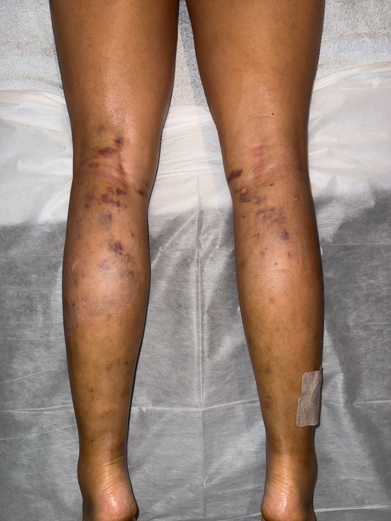 photo seance Bodystudiowa