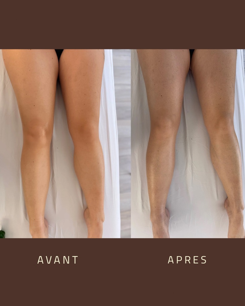 photo portrait Philautia_ma