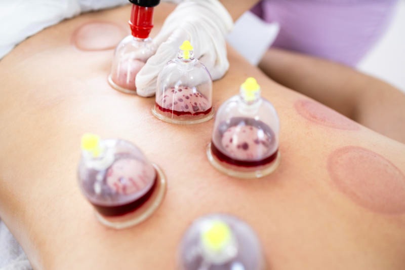 photo seance Naturosafely 