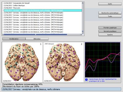 photo activite Lydie Amundarain