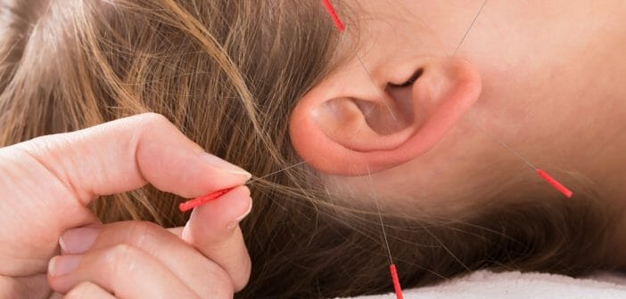 photo seance R. CHAVERONDIER - acupuncture et auriculothérapie