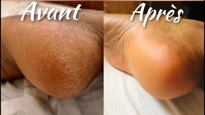 photo diplome MARINA LELONG Luxopuncture, Reflexologie soins