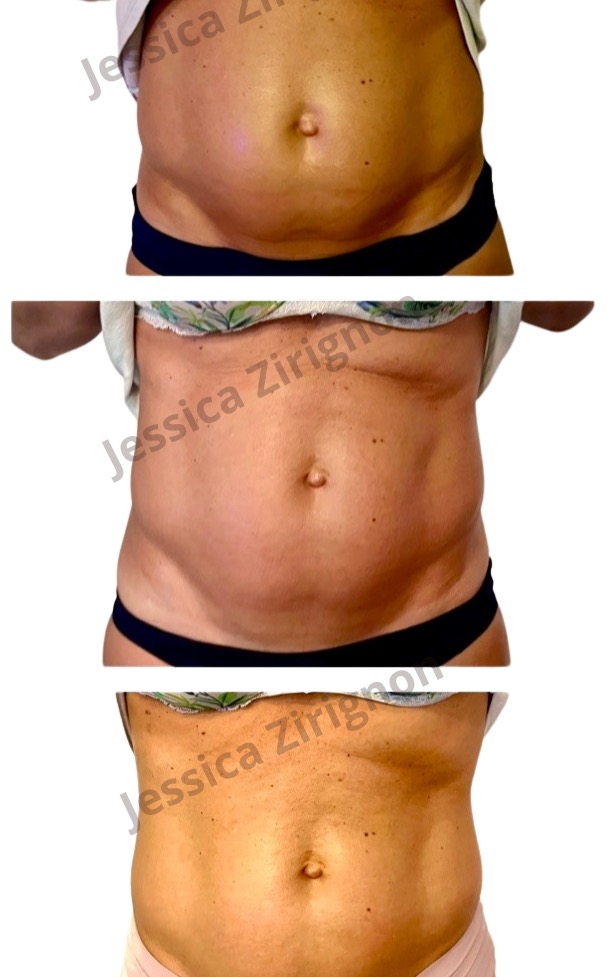 photo seance Jessica Zirignon