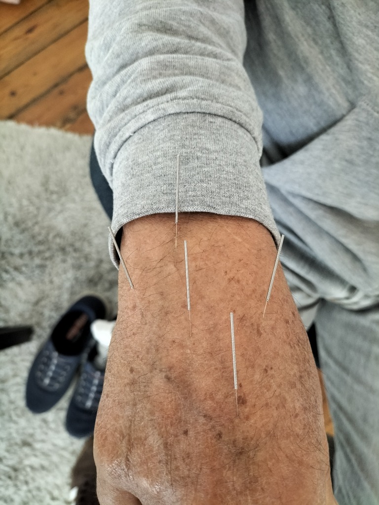 photo activite Hervé RICHET ACUPUNCTEUR