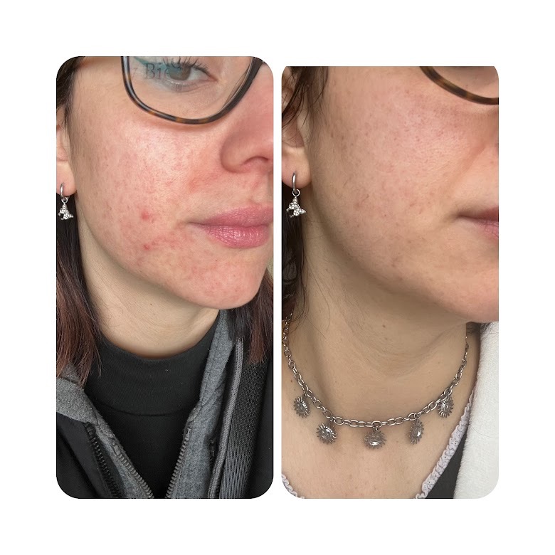 photo seance Blandine Pelletier Magnétiseur Guerisseur  LR