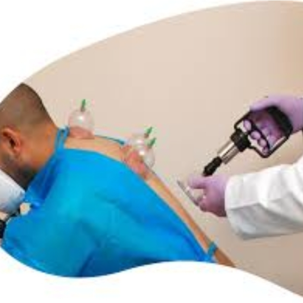 AdamNature/Cupping-Hijama