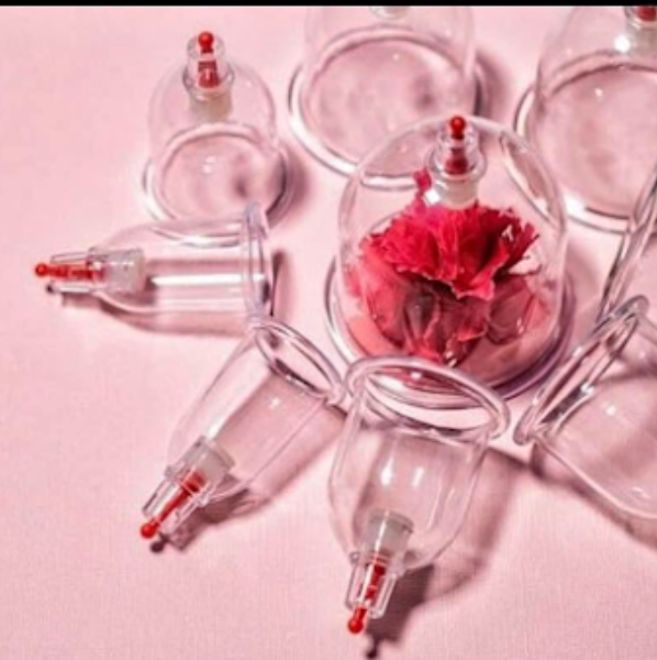 Ccupping hijama Antibes