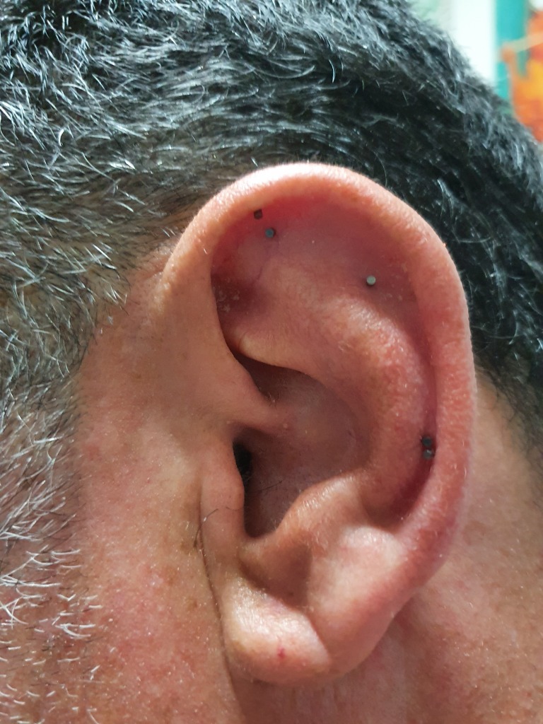 photo seance Clinique EssenCiel