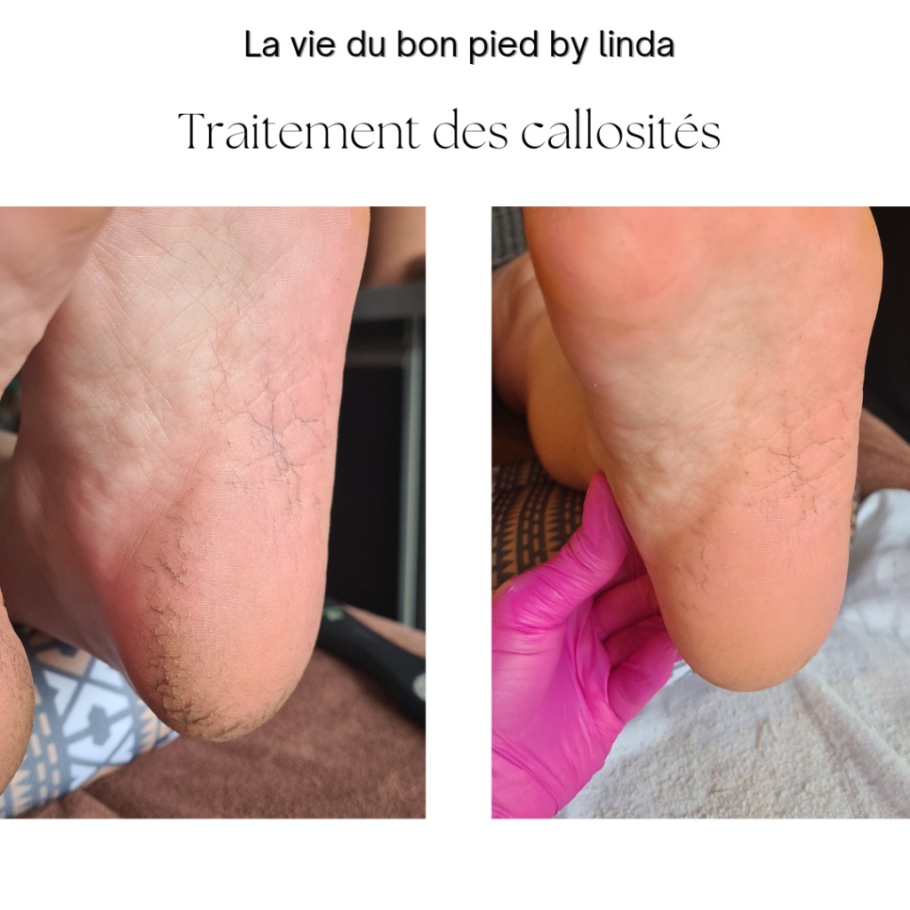 photo seance Buche linda