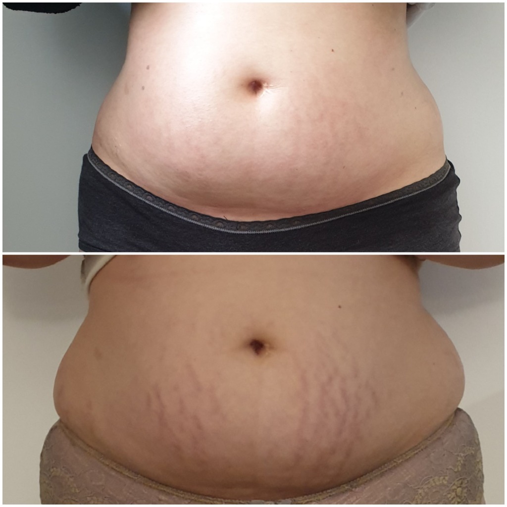 photo activite BODY NATH 