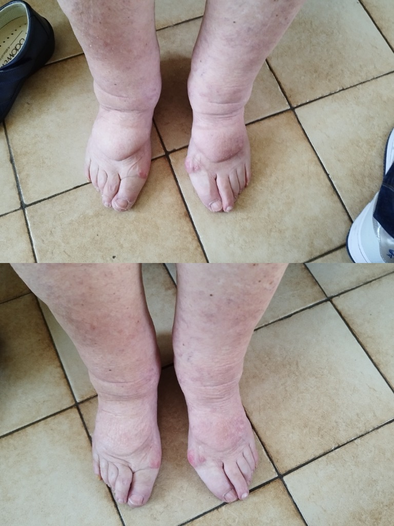 photo activite Sandrine Monchal sophrologue 