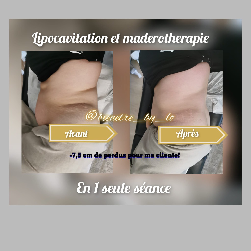 photo activite Laura FRESY 