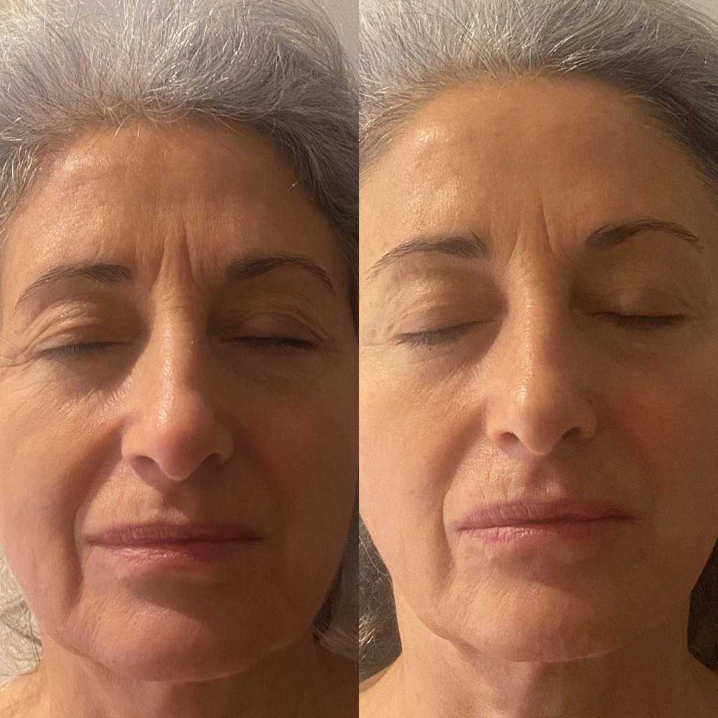 photo seance Bymaude.facialiste 