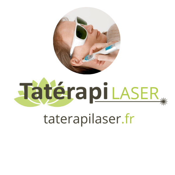 Tatérapi laser
