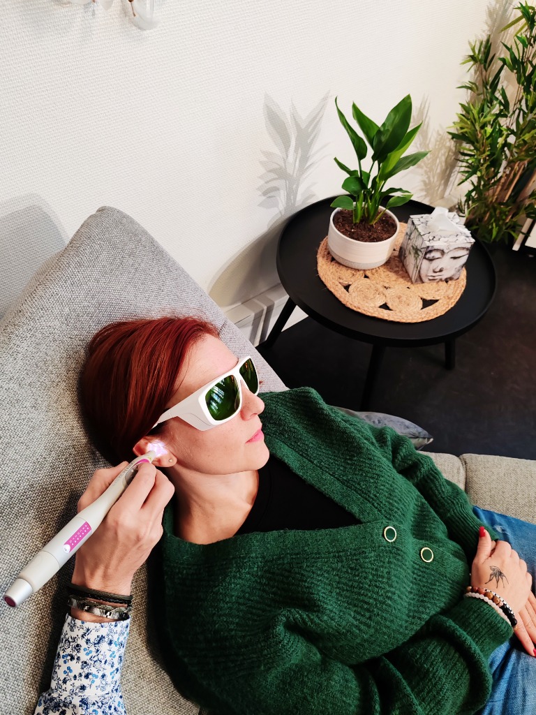 photo seance Tatérapi laser