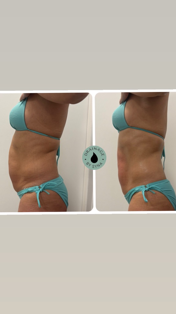 photo activite Drainage by Syna