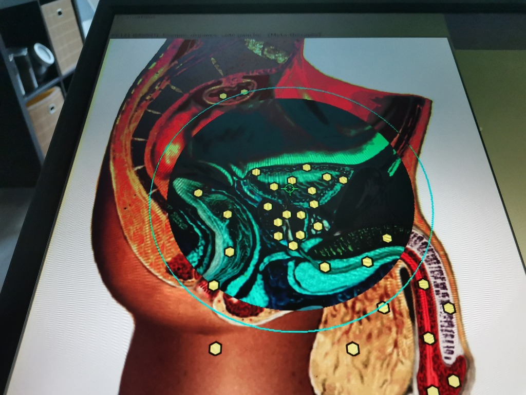 photo activite Raphael Verdon Magnétiseur par Biorésonance