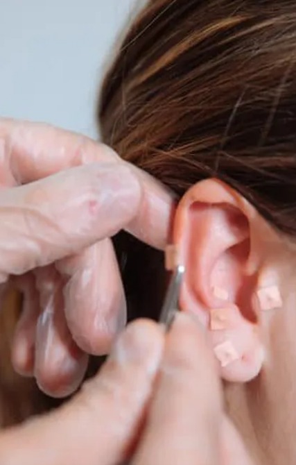 photo activite EliteLaser Paris 