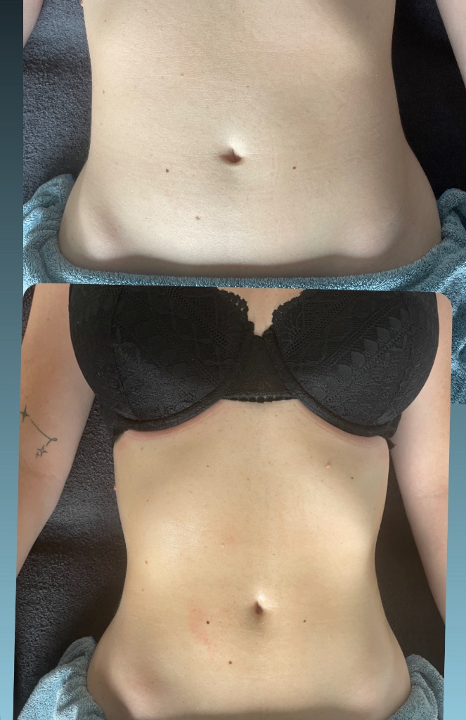 photo activite Claire praticienne en drainage lymphatique renata