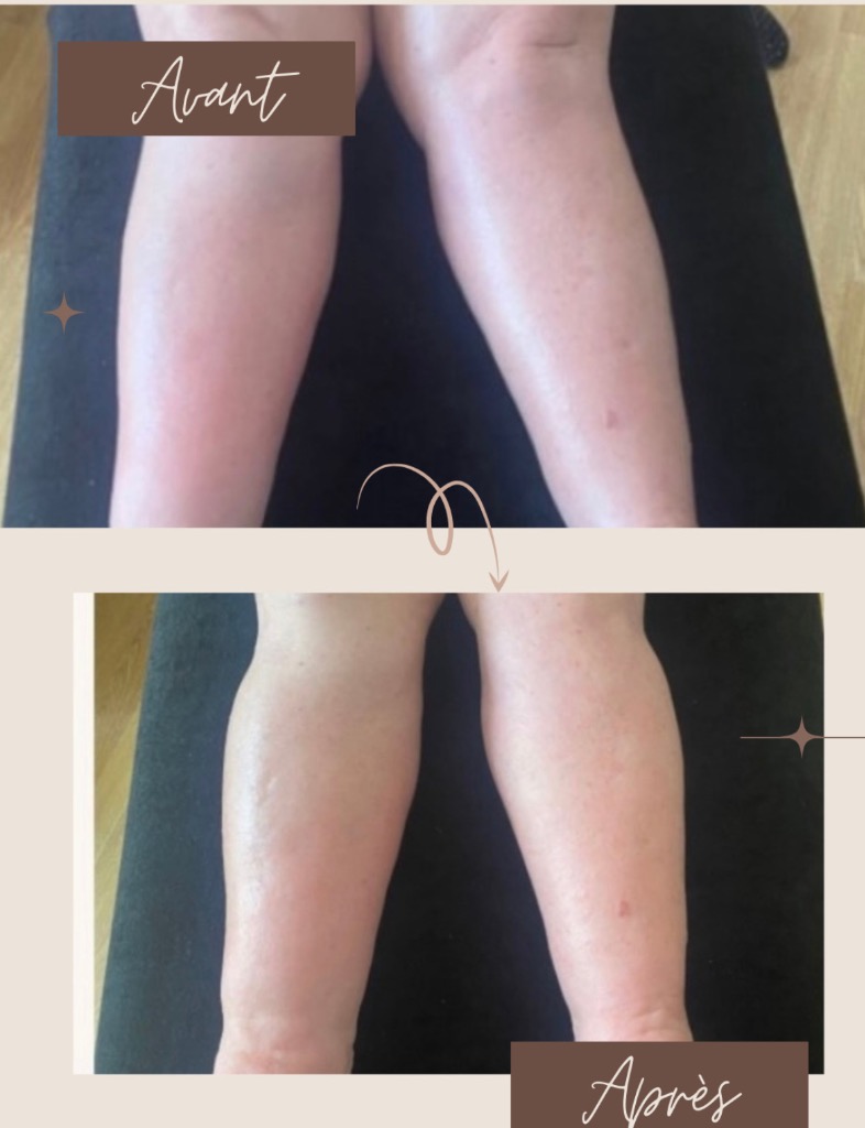 photo diplome Claire praticienne en drainage lymphatique renata