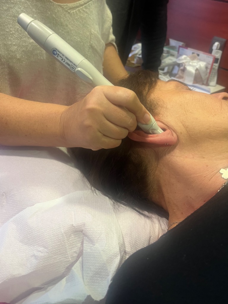 photo seance LASER STOPPER 