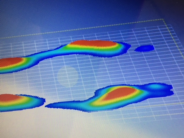 photo seance CENTRE PODOLOGIE ET ORTHOPEDIE 