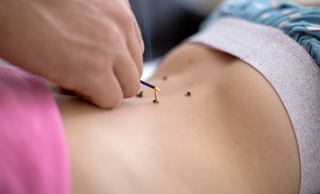 photo activite Centre d’acupuncture Sebastopol