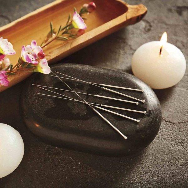 Delphine VERDET acupunctrice et kinésiologie.