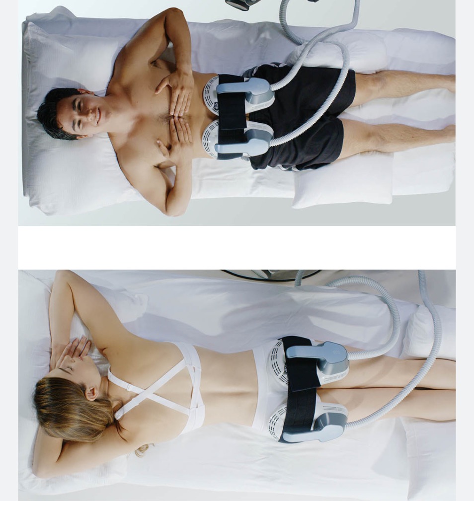 photo seance Emsculpt 