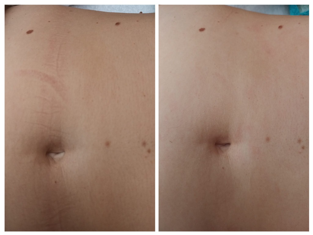 photo seance Lorene Fernandes 