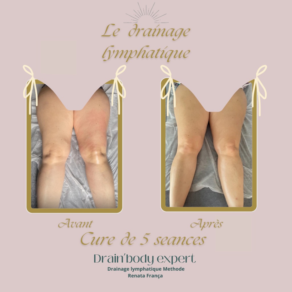 photo cabinet Drain’body expert