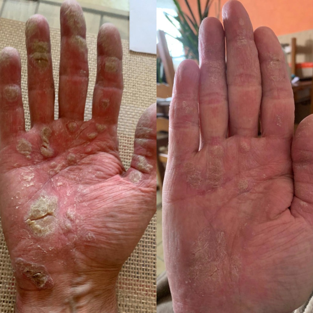 photo seance Carole D Magnétiseur-Radiesthésie-Coupeur de feu