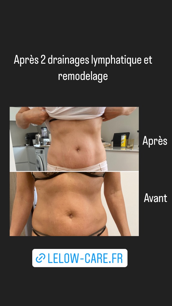 photo seance Lelowcare 