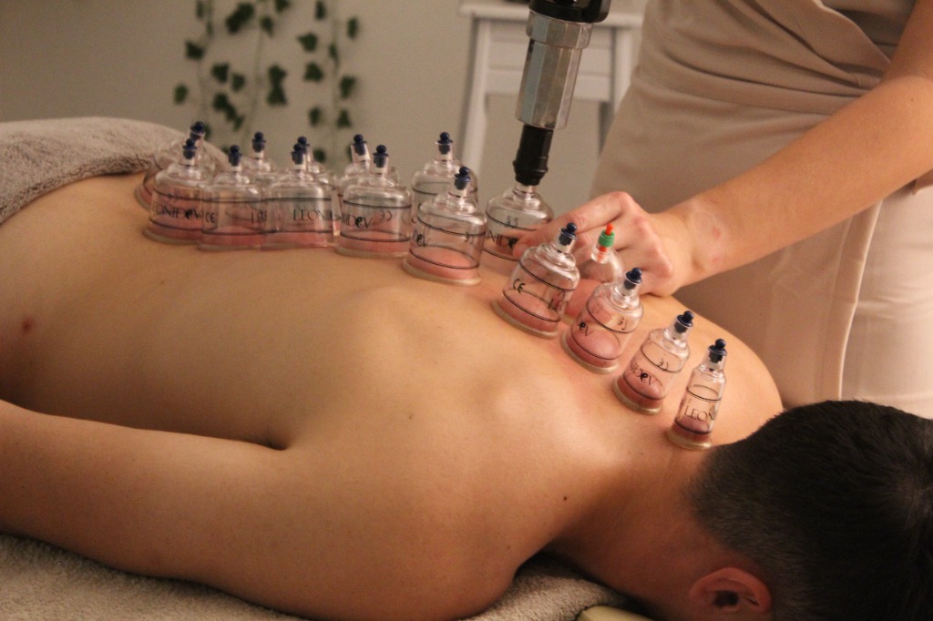 photo activite Léonie Doloue Fit Cupping