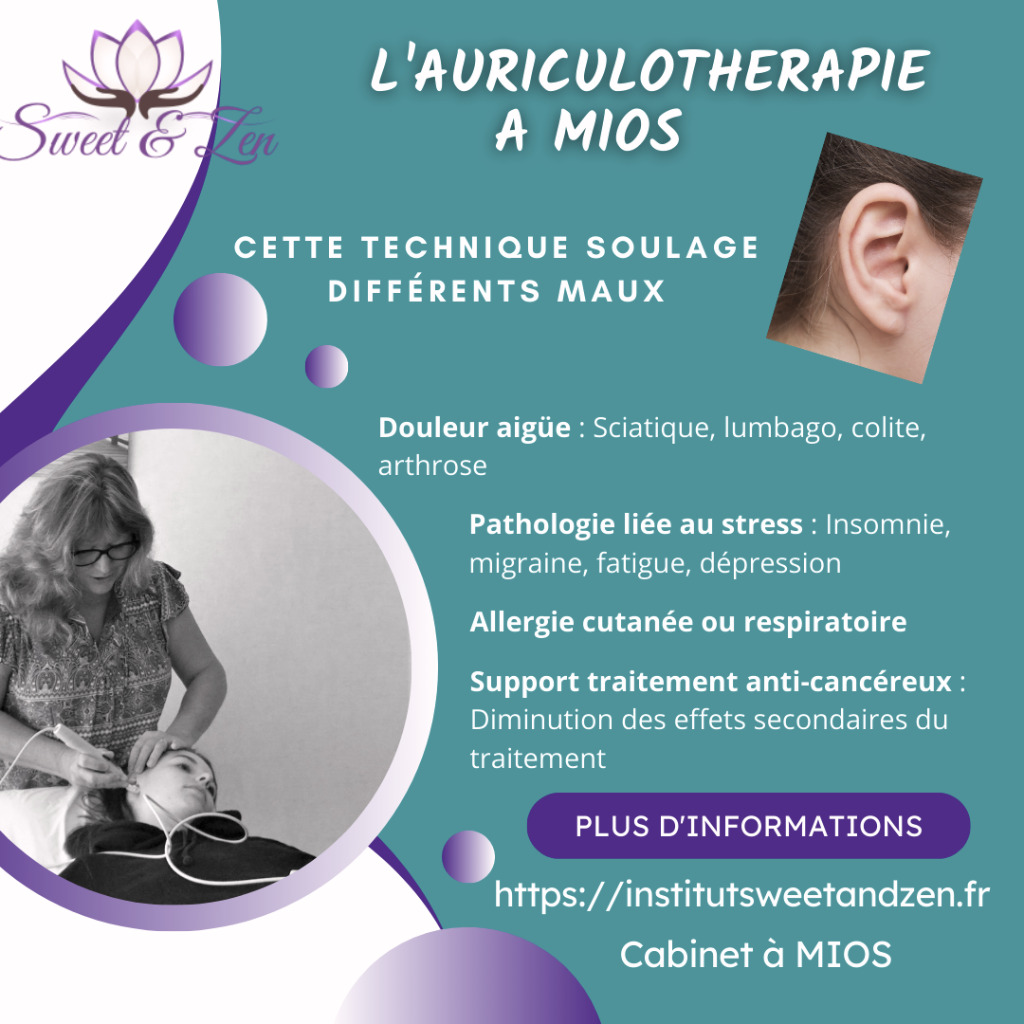 illustration Découvrez l'Auriculothérapie à MIOS