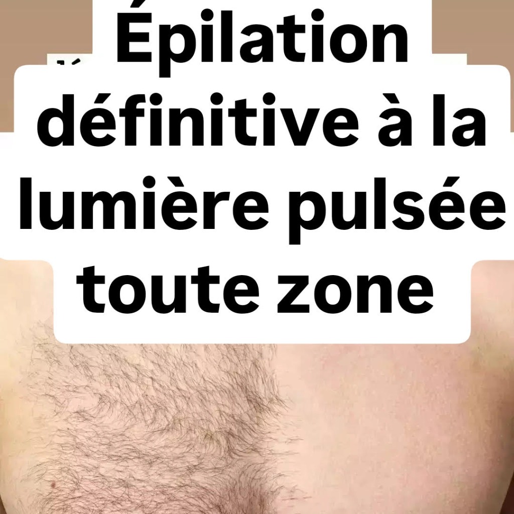 illustration EPILATION DEFINITIVE INDOORE