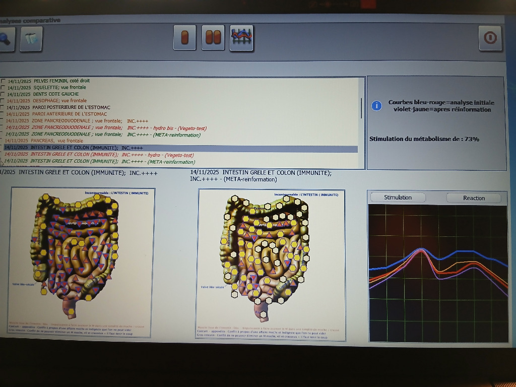 illustration Unique en Savoie : les résultats mesurables de l'hydrothérapie du côlon grâce à la biorésonance