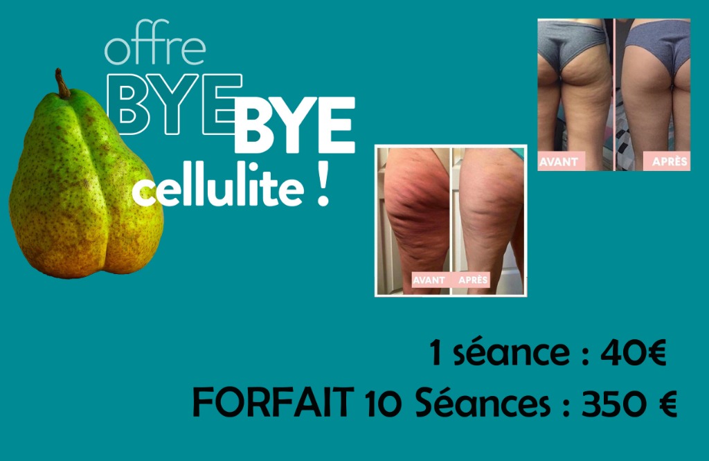 illustration Cupping Thérapie anti-cellulite