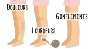 illustration Les troubles circulatoires des membres inférieurs