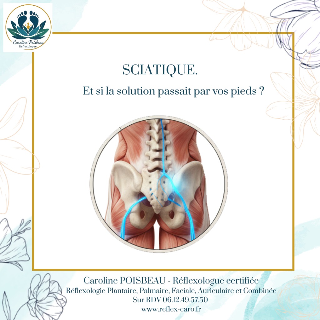 illustration SOULAGER UNE SCIATIQUE